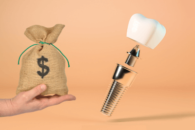 How Much Does a Dental Implant Cost in Albania? Our Prices and What’s Included
