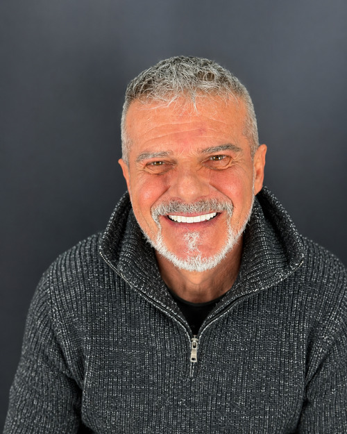 Risultato del sorriso del paziente dopo la procedura con impianti dentali