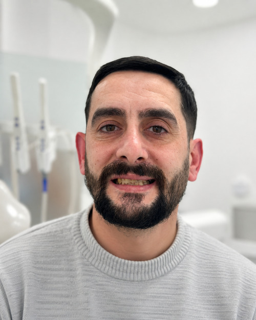 Denti del paziente prima della procedura con impianti dentali