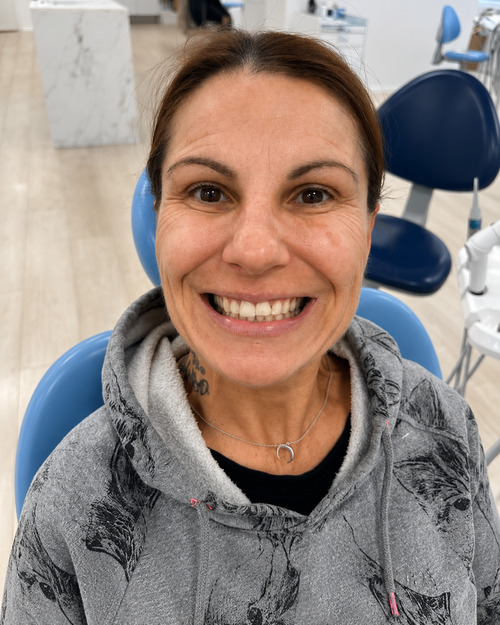 Denti del paziente prima della procedura con impianti dentali